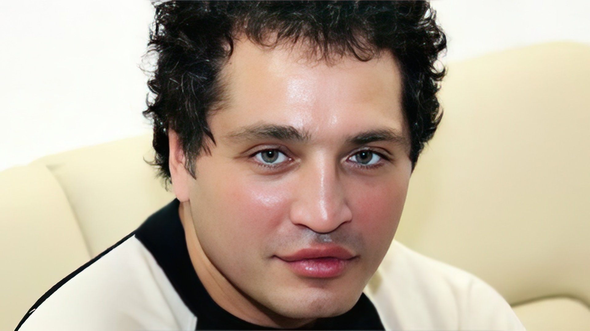 rustam-solntsev-after-plastic-surgery_50