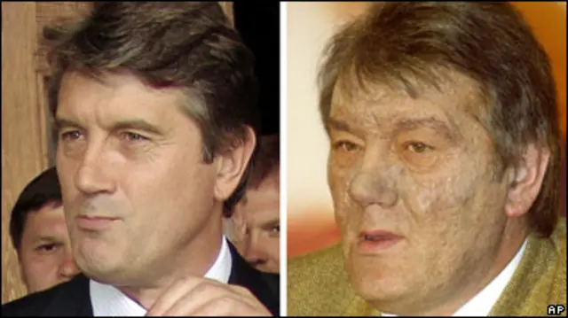 101004124731_yushchenko_poisoning386.jpg